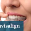 Invisalign